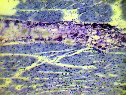 Microscopic View of Tissue